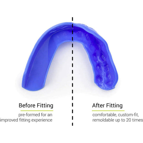 SISU 3D Mouth Guard - Hot Pink